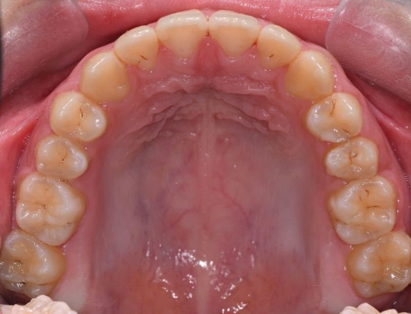 A close up of a person 's mouth showing their teeth.