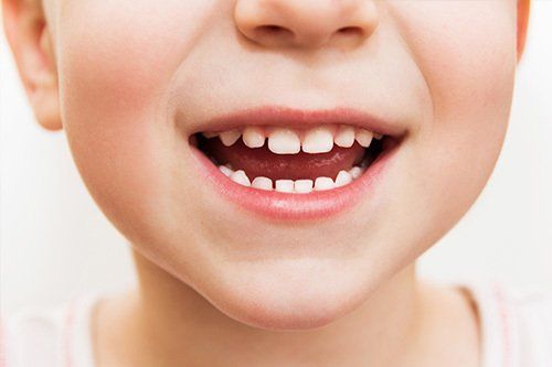 lower have of child's have with open mouth