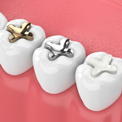 Three molars with gold, silver, and white dental crowns on pink gums