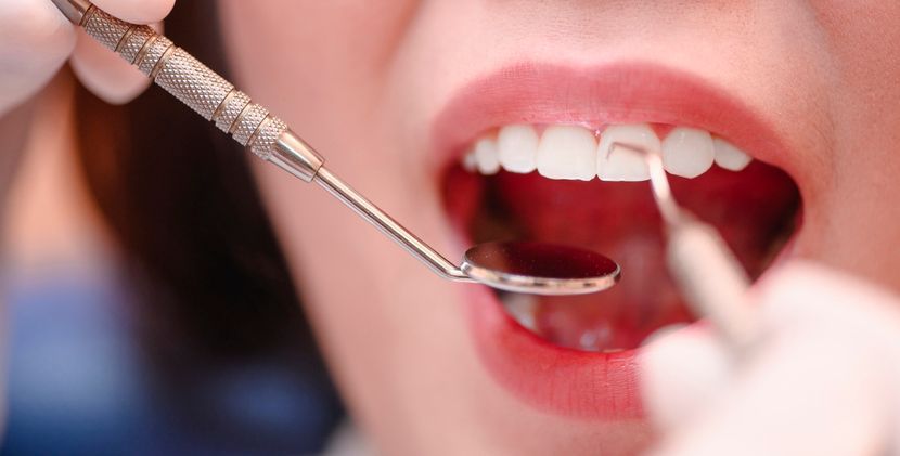 A dentist examines a patient's teeth using a dental mirror and an explorer tool.