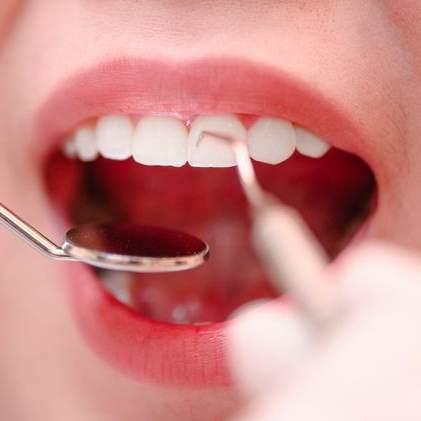 Close-up of a child’s open mouth during a dental exam, with a mirror and tool visible