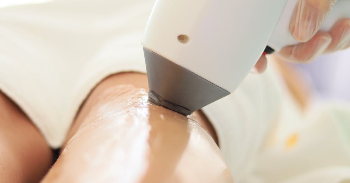 A woman is getting a laser hair removal treatment on her legs.