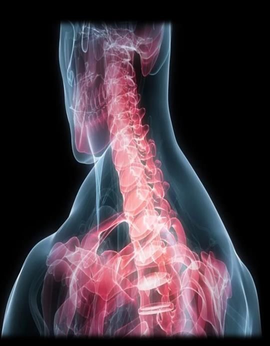 X-ray of human upper body highlighting the spine, bones in red. X-ray of human upper body highlighting the spine, bones in red.