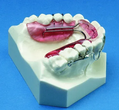 Dental retainer on a model of teeth, pink plastic, silver metal wires, angled on a blue surface.