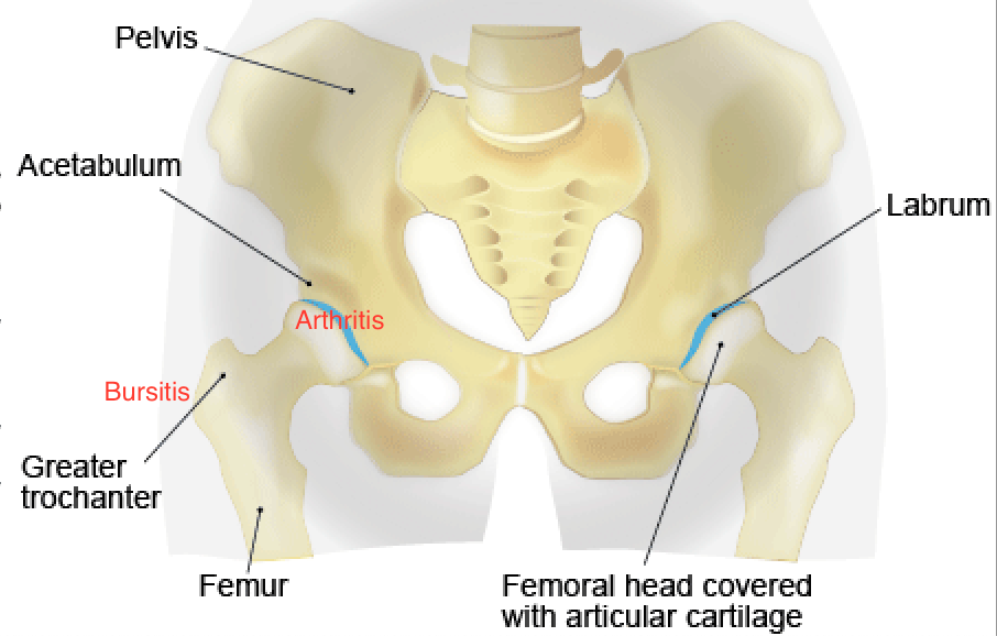 Kidney stone, urinary stone, ureteric stone, renal calculi, renal colic, nephrolithiasis