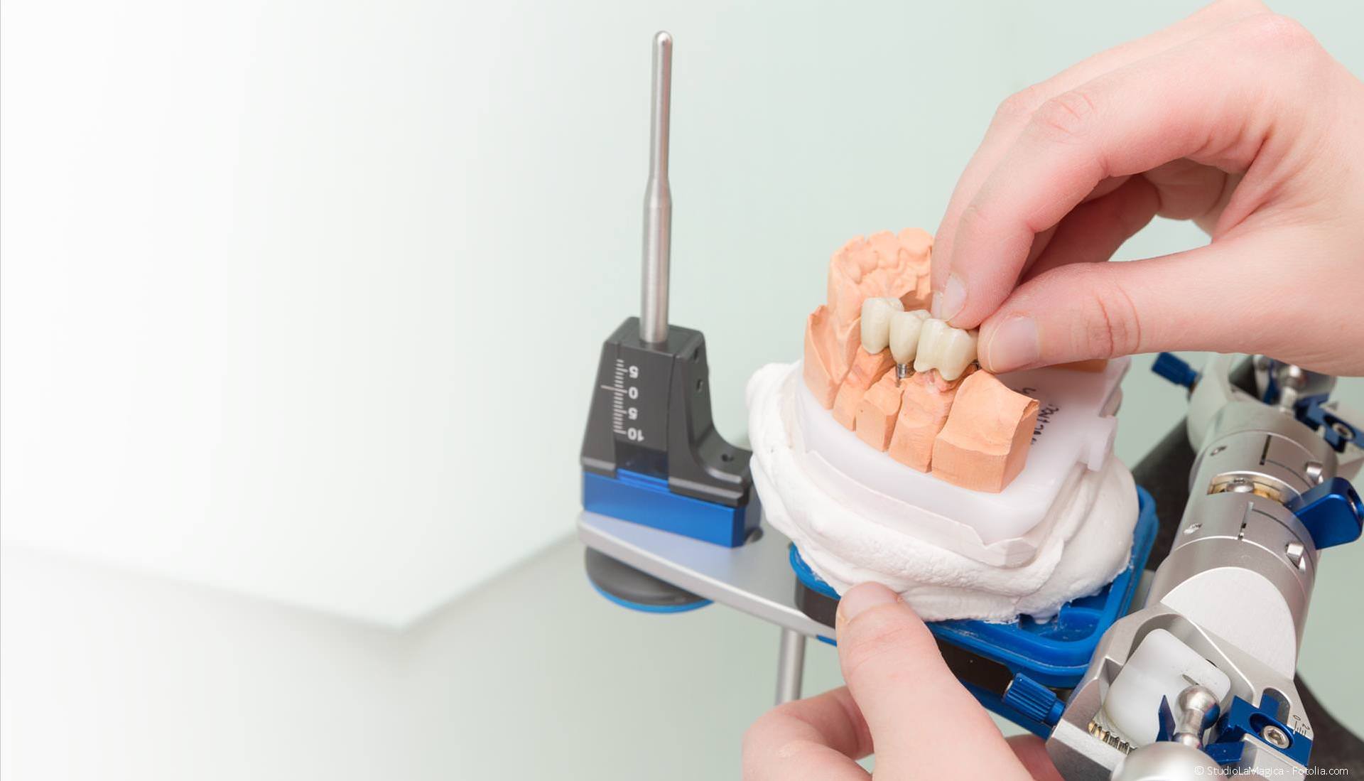 Zahntechnik: Zahnersatz-Herstellung im Dentallabor
