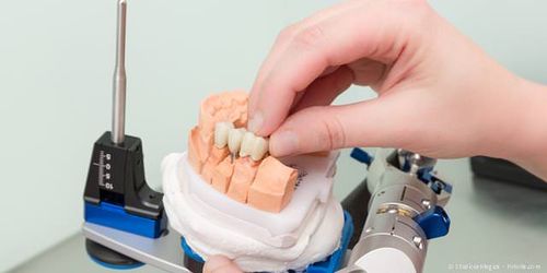 Zahntechnik: Wie Zahnersatz im Dentallabor hergestellt wird