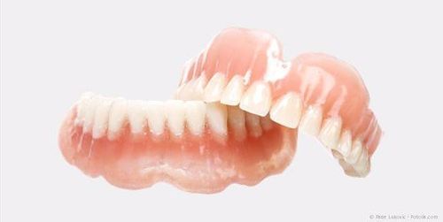 Totalprothesen (Vollprothesen), wenn alle Zähne fehlen