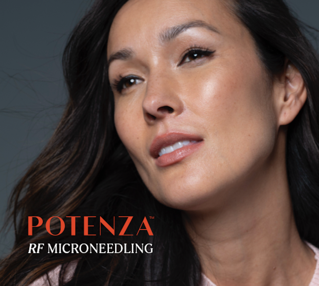 A close up of a woman 's face with the words potenza rf microneedling