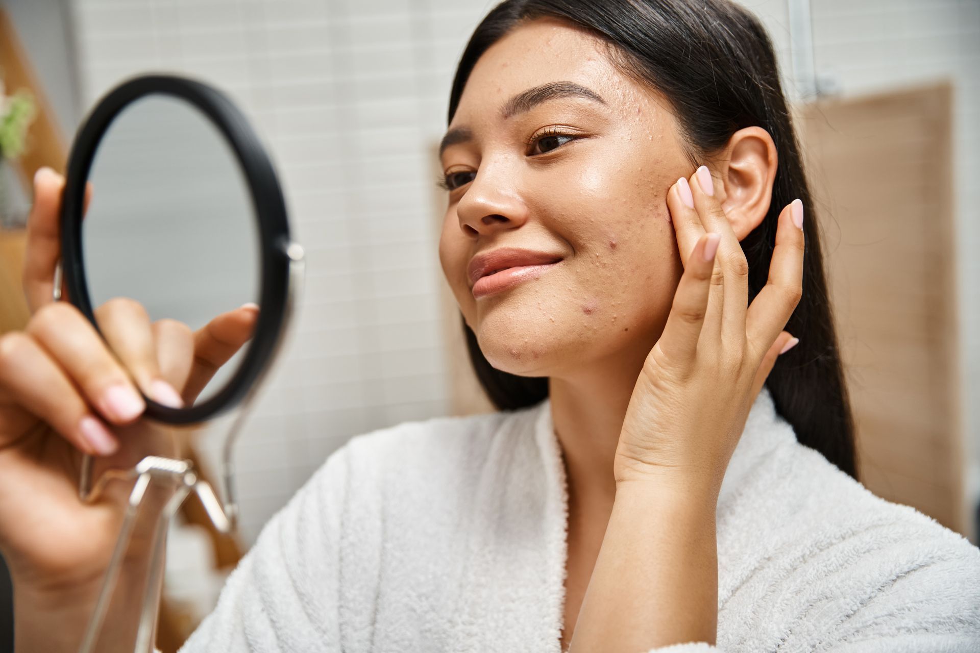 Acne Scarring Treatment 