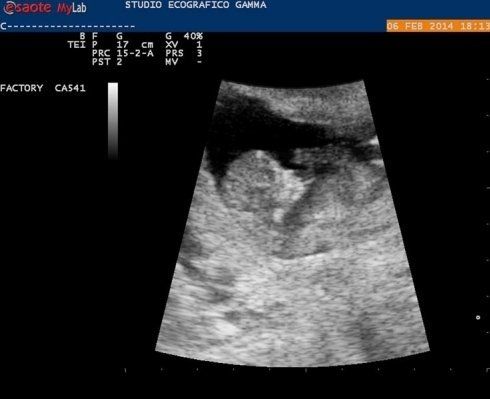 Ecografia addominale