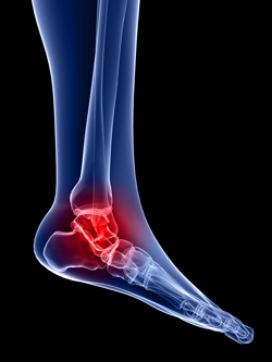 Ankle X-Ray — Webster, TX — Ian J Reynolds MD F.A.A.O.S.