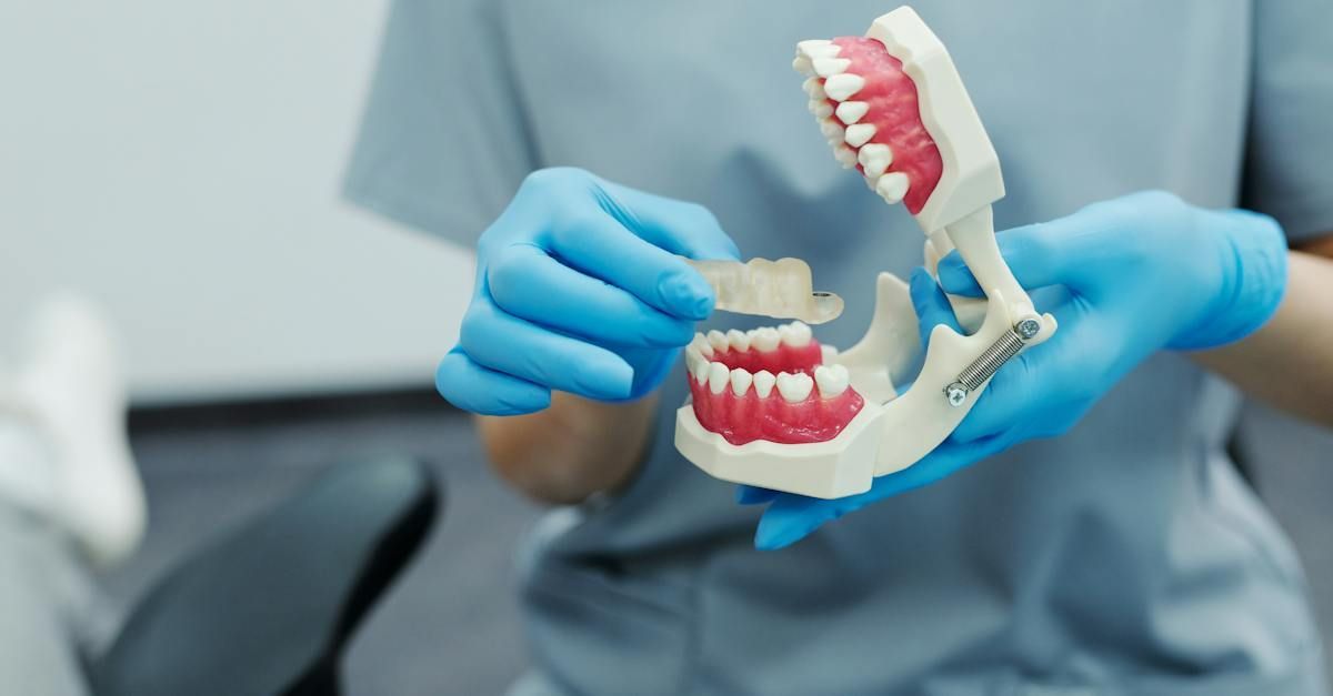 A dentist is holding a model of a person 's teeth.