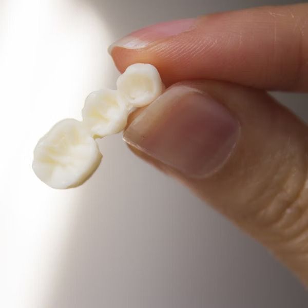 A person is holding a dental bridge in their hand.