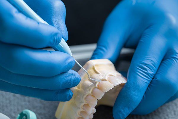 Dental Gypsum — Philadelphia, PA — Bill's Denture & Repair Lab