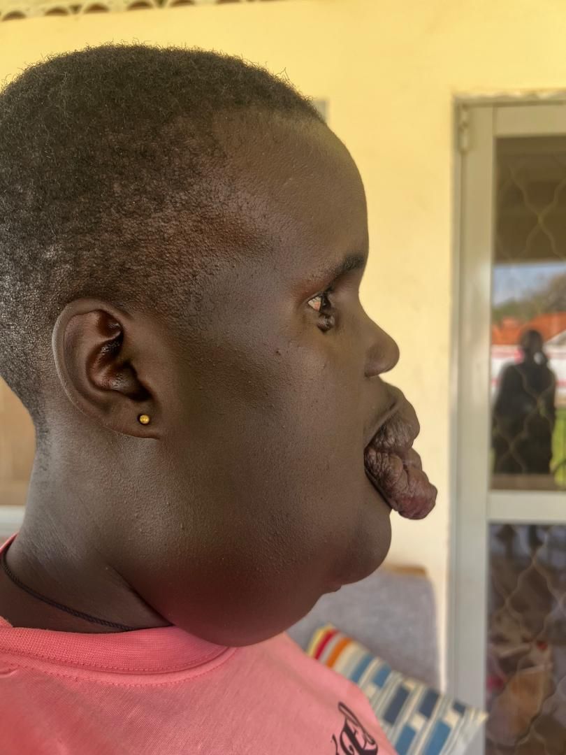 Young Lady with a large tongue protruding, viewed in profile, wearing a pink shirt, outdoors.