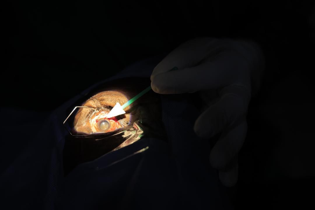 Close-up of a person's eye during surgery, illuminated by a spotlight. A medical tool is used on the eye.