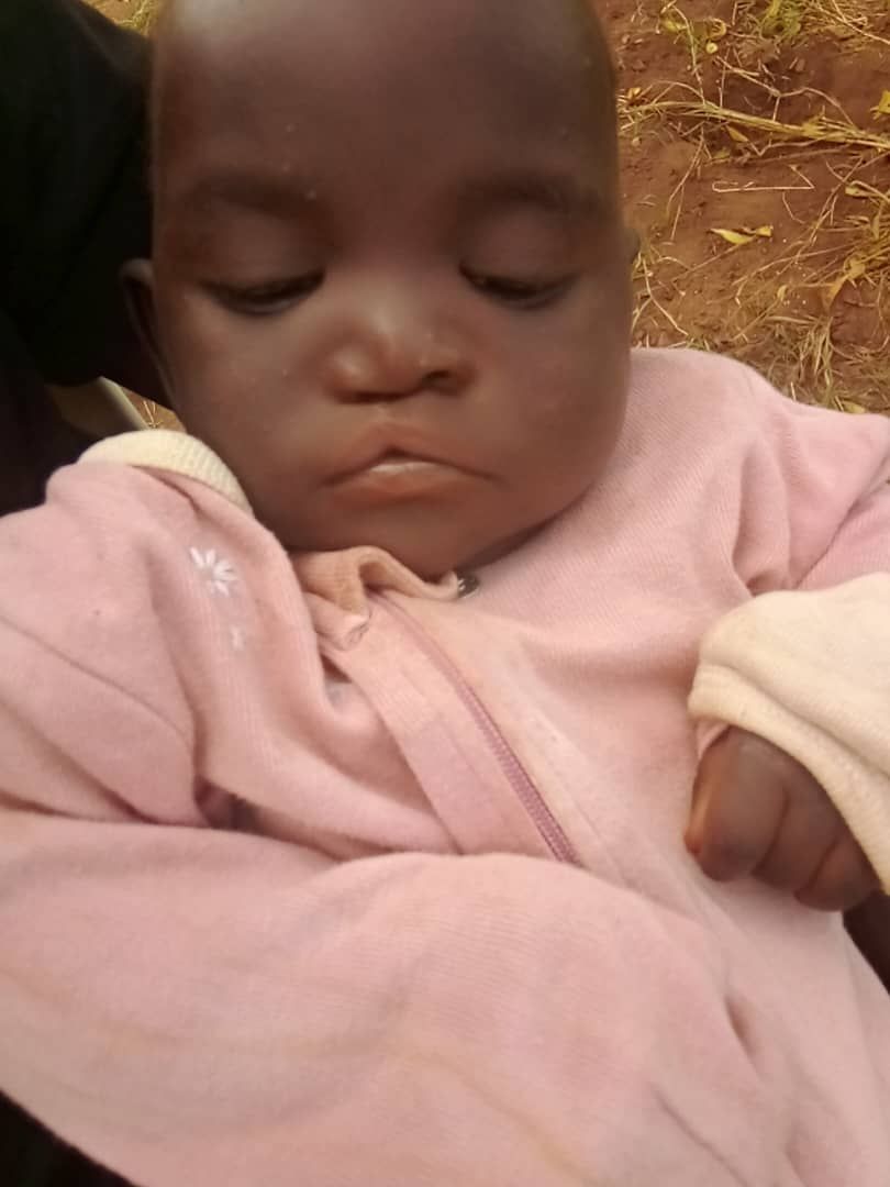 Rwottwero Godfrey healed after Bethel Smile cleft lip surgery, November 2025