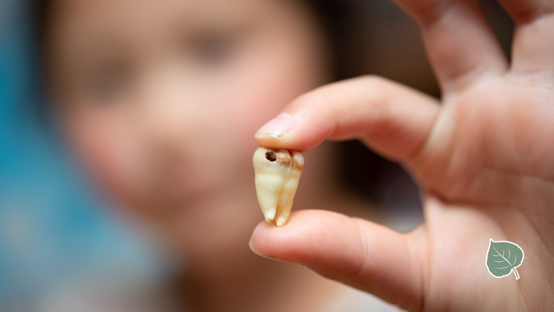A person is holding a tooth with a hole in it in their hand.