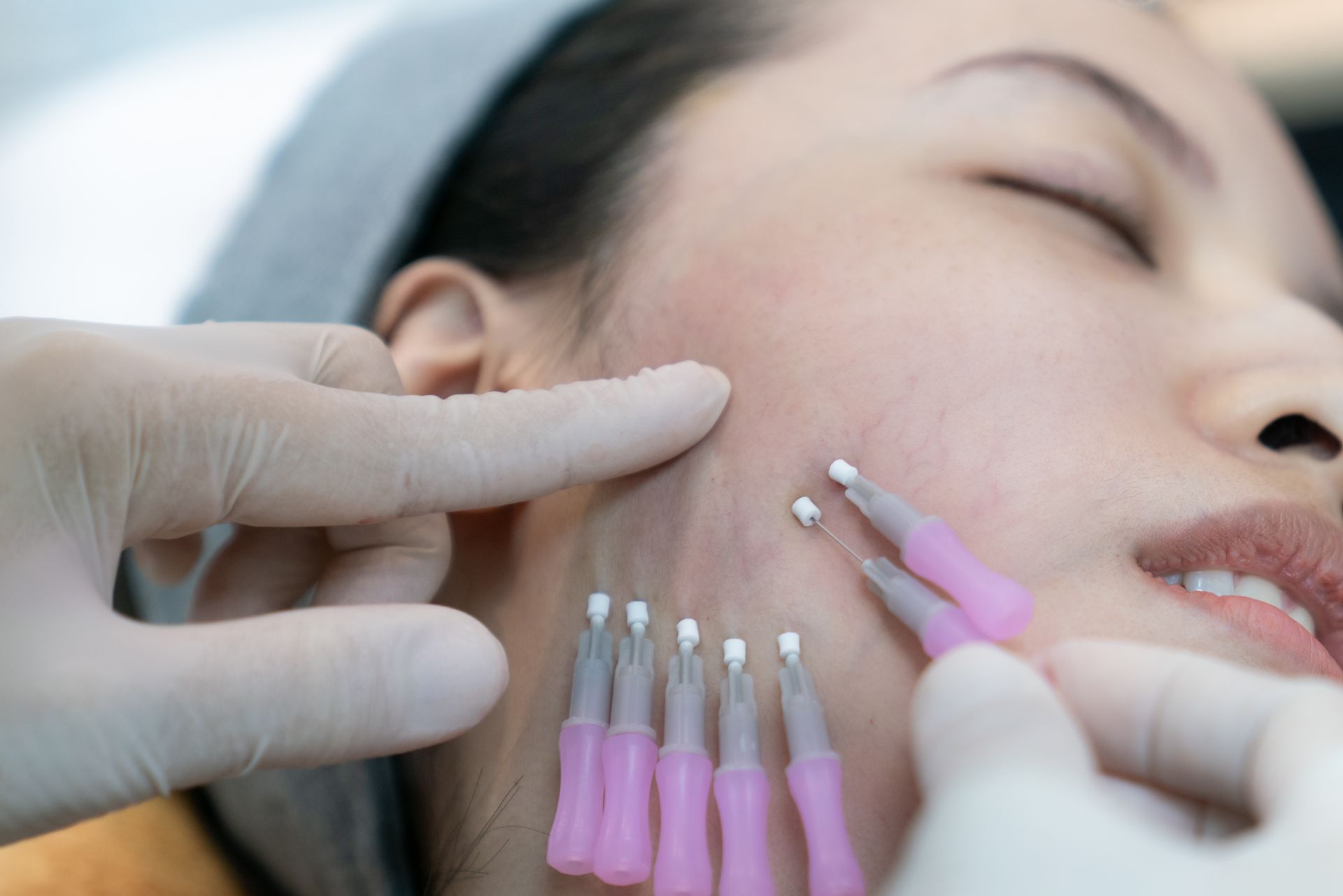 A woman is getting a botox injection in her face.