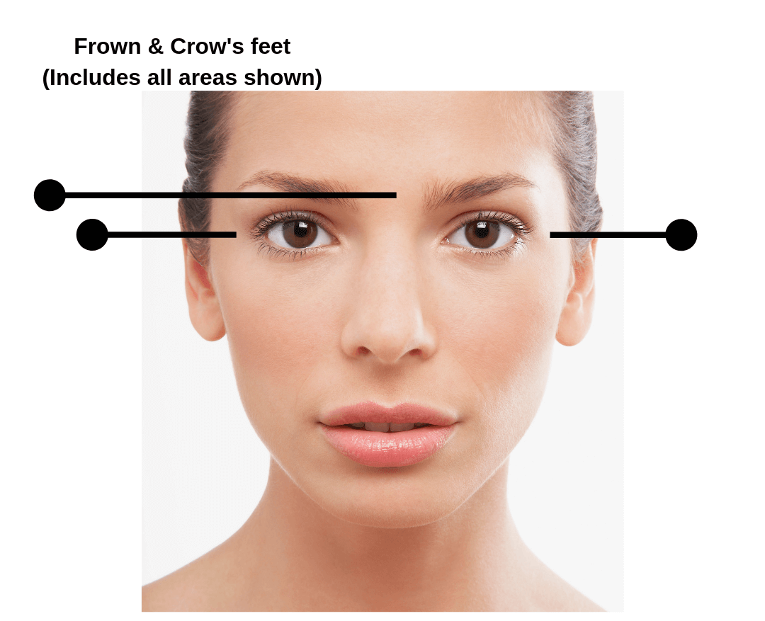 A picture of a woman 's face with the words fromm & crow 's feet including all areas shown