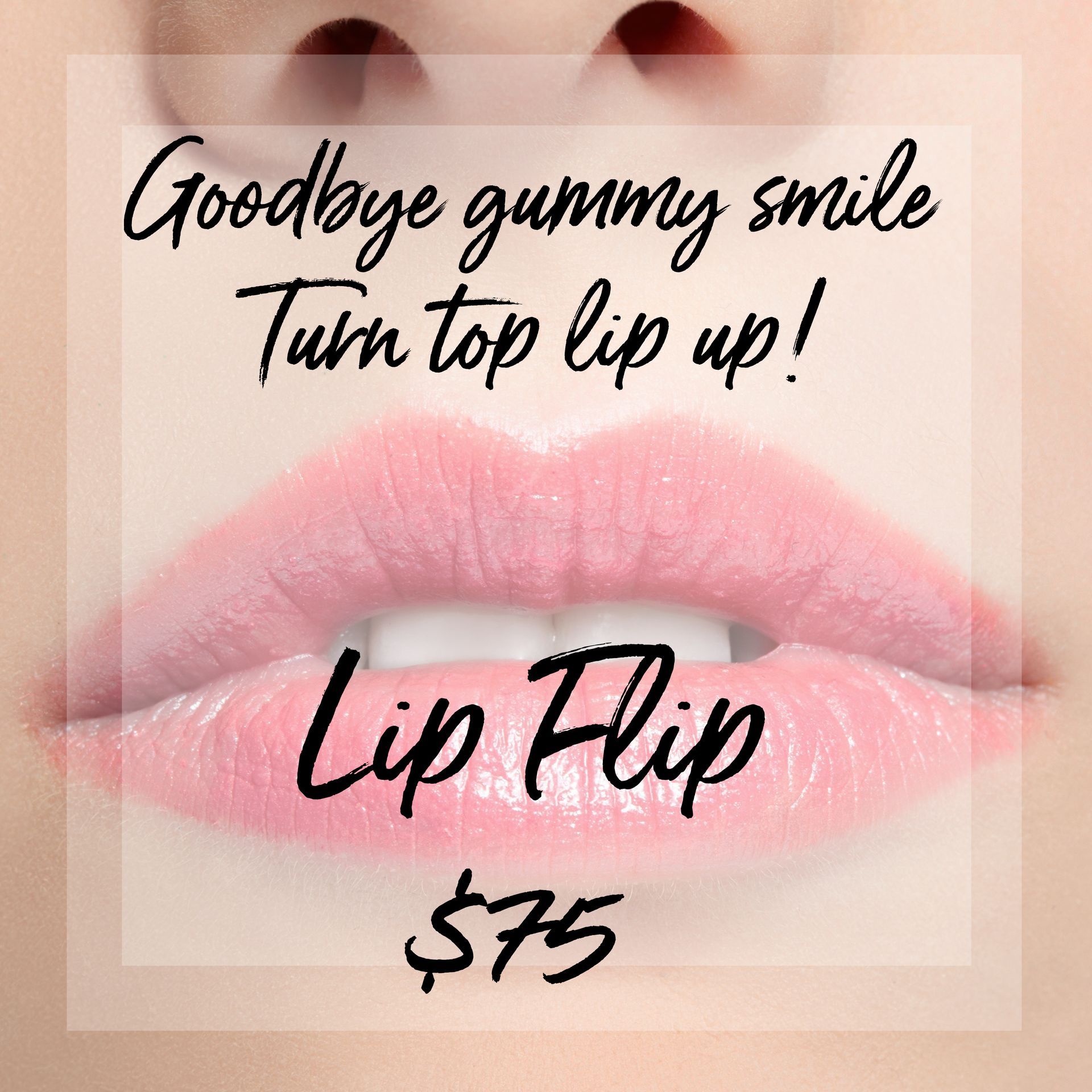 A picture of a woman 's lips with the words goodbye gummy smile turn top lip up