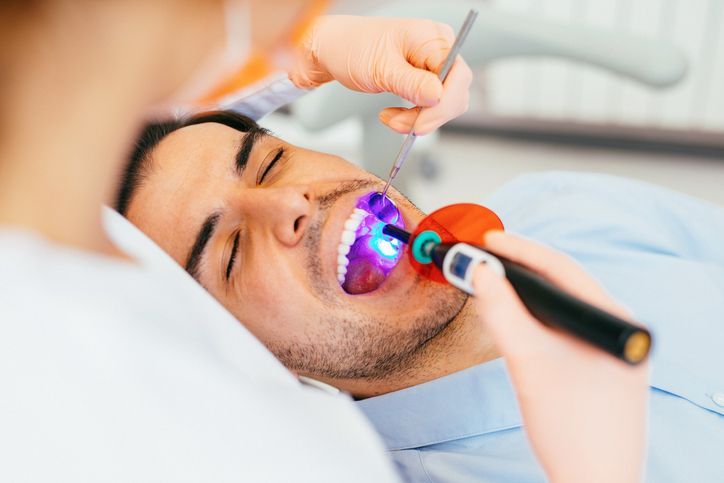Dentist using a curing light on a patient’s open mouth during a dental procedure