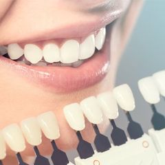 Cosmetic Dentistry — Perfect White Teeth in Modesto, CA