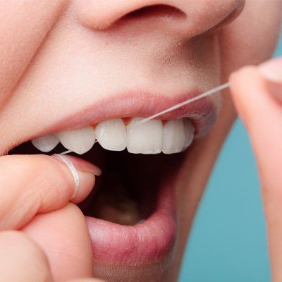 Flossing Regularly — Flossing Teeth in Modesto, CA