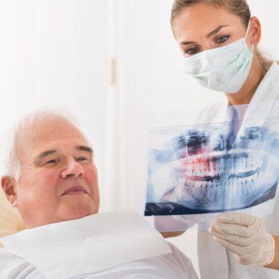 Damaged Teeth — Elder Implant Xray in Modesto, CA