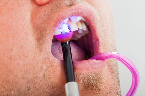 Cosmetic Dentistry — Damaged Teeth in Modesto, CA