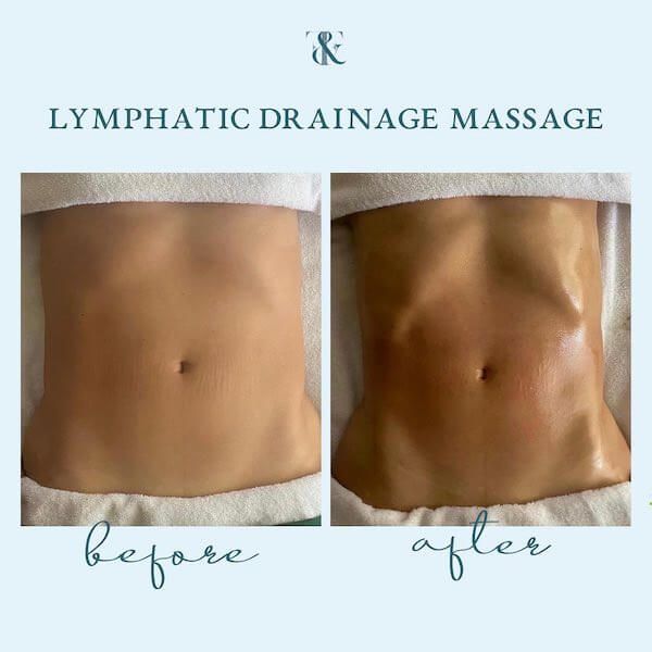 Signature Lymphatic Duo | Lymphatic Drainage Massage Treatment Chicago