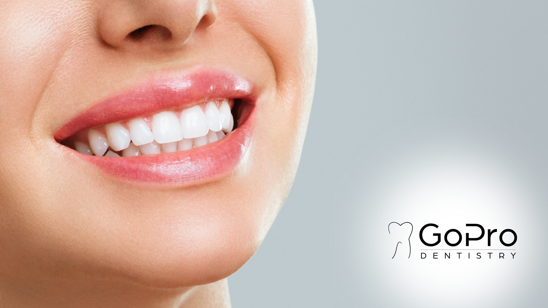 A close up of a woman 's mouth with white teeth.