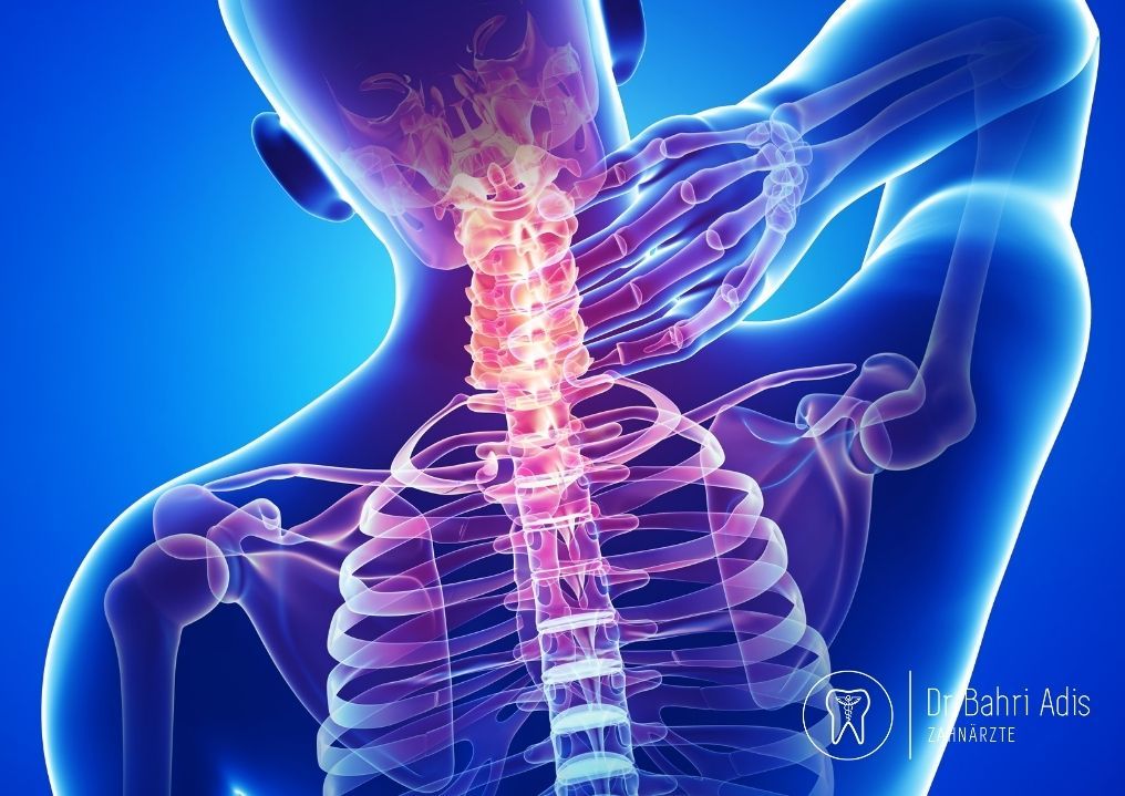 Röntgenähnliche Darstellung des menschlichen Nackens und oberen Rückens; rote Markierungen zeigen Schmerzen an.