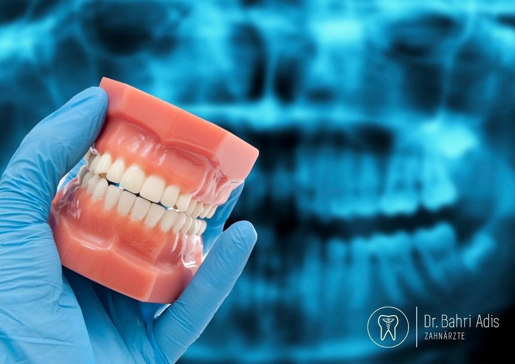 Hand hält ein Zahnmodell vor einem Zahnröntgenbild; blaue Handschuhe, Zähne, hellblauer Hintergrund.