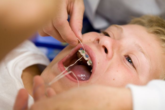 Little Boy Having His Teeth Examined By A Dentist — Katy, Texas — Katy Dental Studio