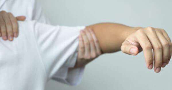 physiotherapist working on a man with adhesive capsulitis