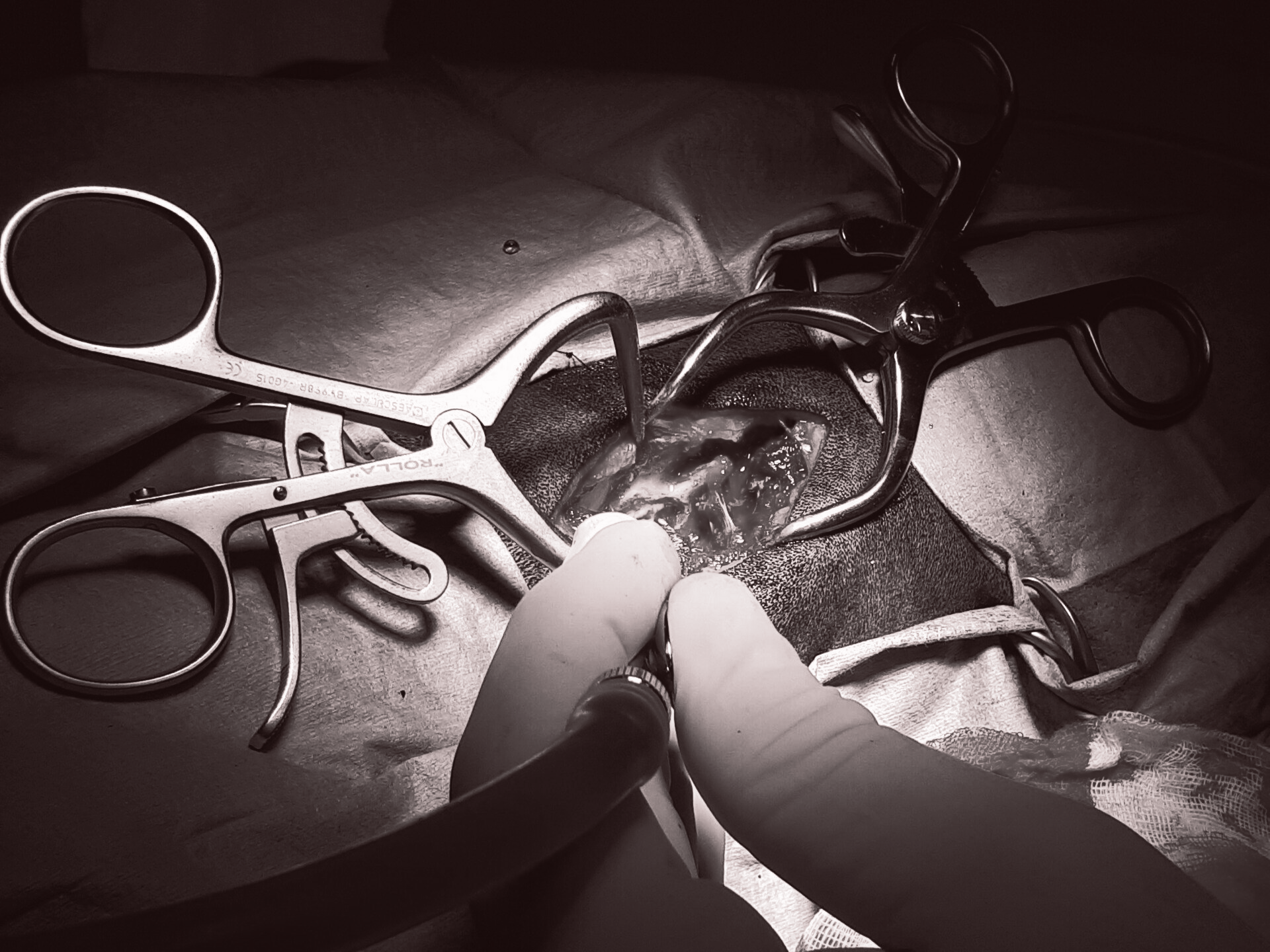 Chirurgia e anestesia