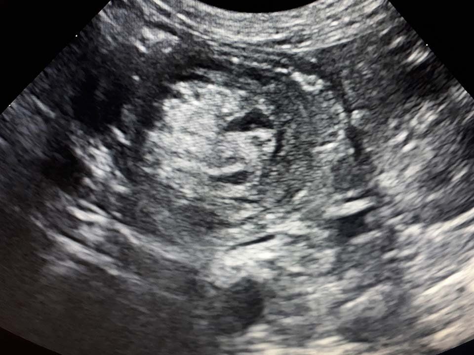 Ecografia e Radiologia