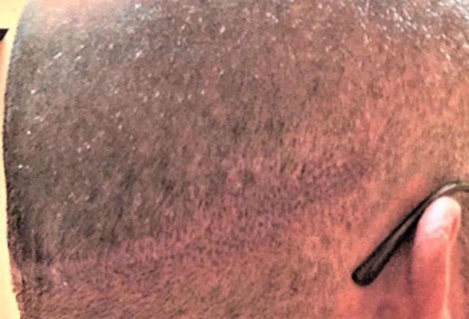 A close up of a man 's head with glasses on.