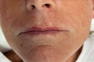 A close up of a woman 's face with a scar on her lip.