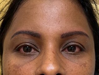 A close up of a woman 's face with freckles and brown eyes.