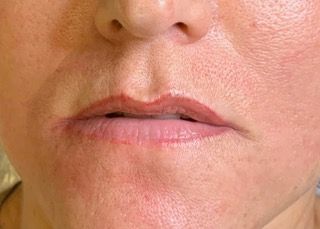 A close up of a woman 's lips and nose.