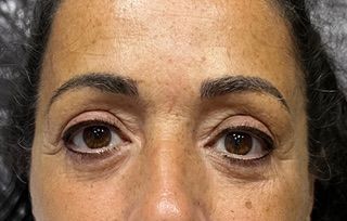 A close up of a woman 's face with brown eyes and wrinkles.