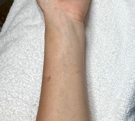 A close up of a person 's wrist on a white towel.