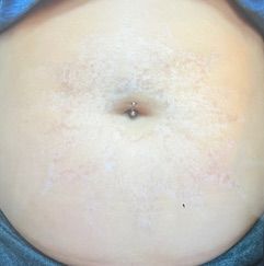 A close up of a person 's belly with a navel piercing.