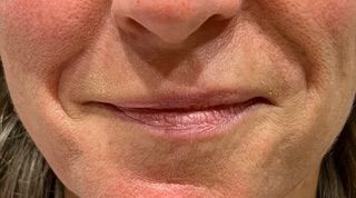 A close up of a woman 's mouth with wrinkles.