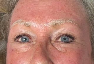 A close up of a woman 's face with a broken eyebrow.
