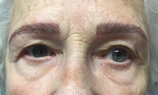A close up of an elderly woman 's eyes and eyebrows.