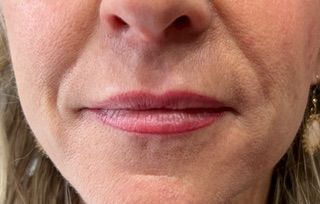 A close up of a woman 's face with wrinkles and pink lips.